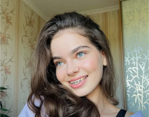 أنواع تقويم الأسنان الآخرى